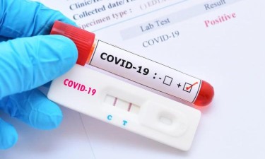 Associação das Farmácias afirma que Minsa está a complicar com os testes de covid-19