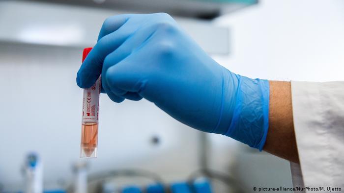 Angola já recebeu as primeiras doses de vacinas